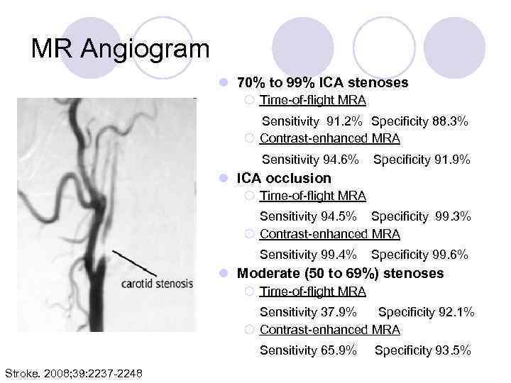 MR Angiogram l 70% to 99% ICA stenoses ¡ Time-of-flight MRA Sensitivity 91. 2%