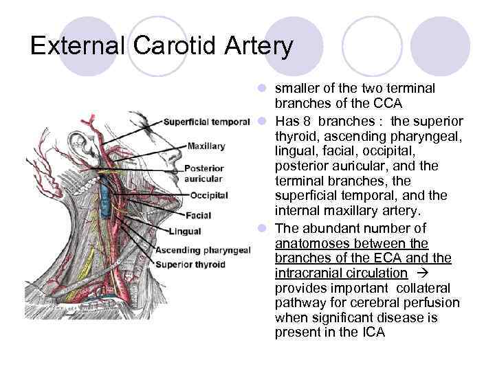 Carotid Artery Disease Anatomy Transverse Aortic Arch