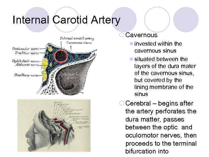 Internal Carotid Artery ¡ Cavernous l invested within the cavernous sinus l situated between