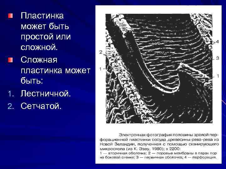 1. 2. Пластинка может быть простой или сложной. Сложная пластинка может быть: Лестничной. Сетчатой.