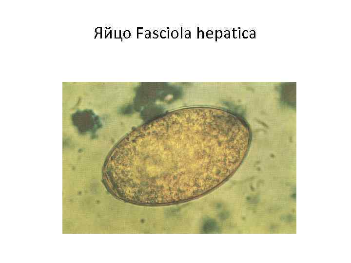 Яйцо Fasciola hepatica 