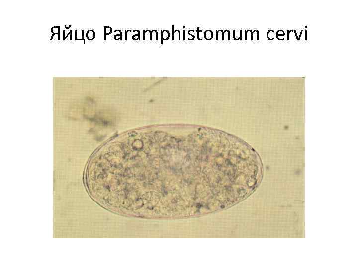 Яйцо Paramphistomum cervi 