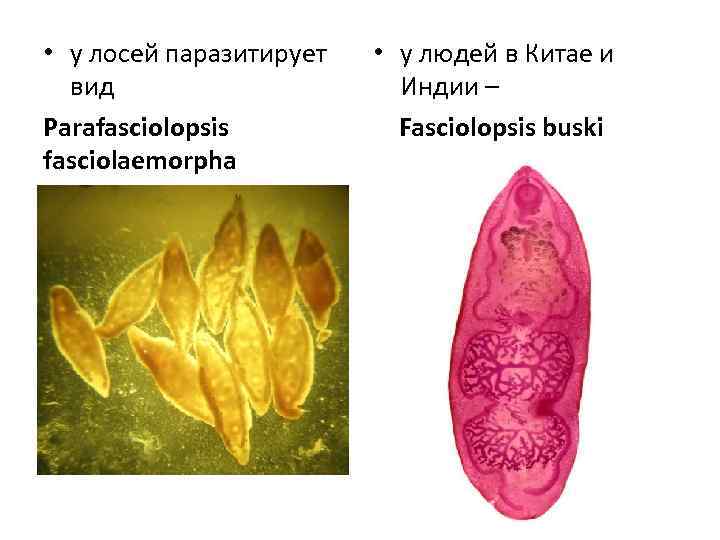  • у лосей паразитирует вид Parafasciolopsis fasciolaemorpha • у людей в Китае и