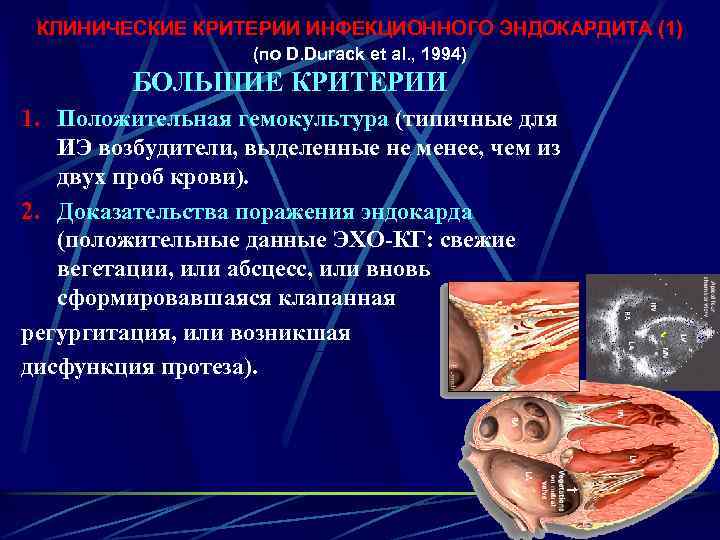 КЛИНИЧЕСКИЕ КРИТЕРИИ ИНФЕКЦИОННОГО ЭНДОКАРДИТА (1) (по D. Durack et al. , 1994) БОЛЬШИЕ КРИТЕРИИ