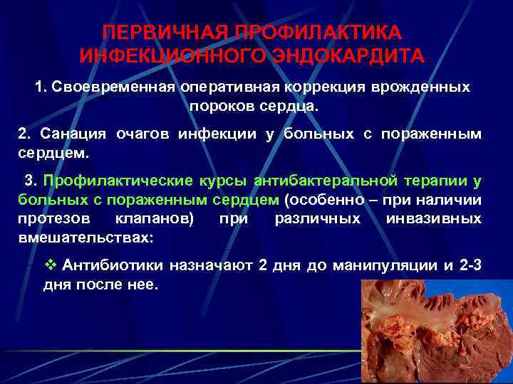 ПЕРВИЧНАЯ ПРОФИЛАКТИКА ИНФЕКЦИОННОГО ЭНДОКАРДИТА 1. Своевременная оперативная коррекция врожденных пороков сердца. 2. Санация очагов