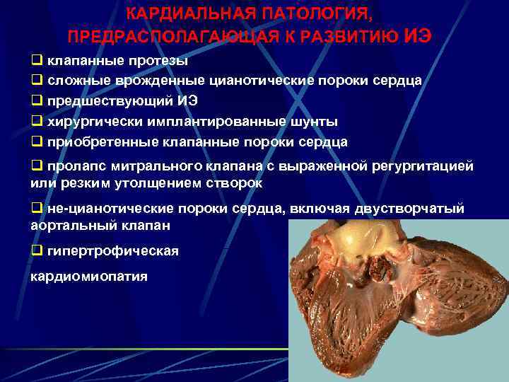 КАРДИАЛЬНАЯ ПАТОЛОГИЯ, ПРЕДРАСПОЛАГАЮЩАЯ К РАЗВИТИЮ ИЭ q клапанные протезы q сложные врожденные цианотические пороки