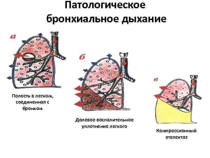 Патологическое дыхание рисунок