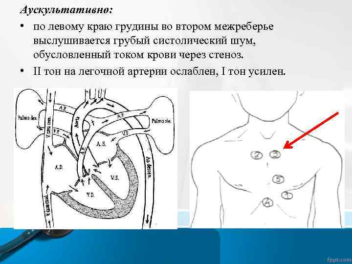 Особенностью аускультативной картины сердца у детей является тест