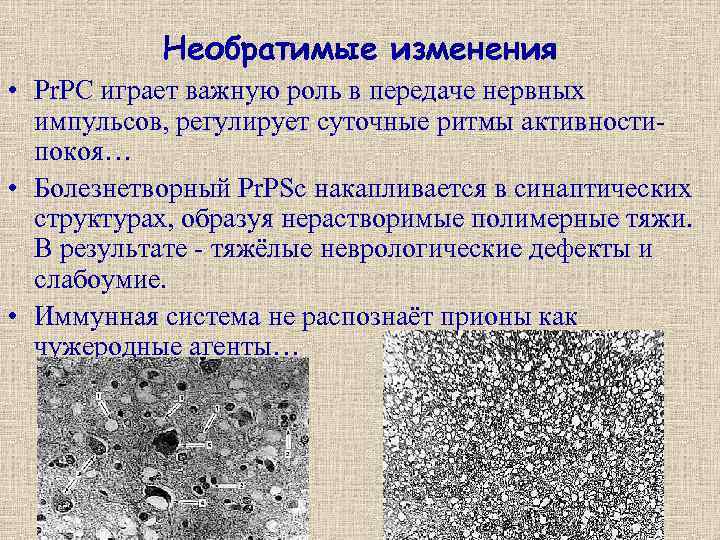 Необратимые изменения • Pr. PC играет важную роль в передаче нервных импульсов, регулирует суточные