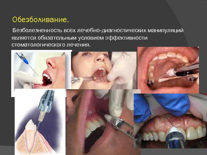 Обезболивание. Безболезненность всех лечебно диагностических манипуляций является обязательным условием эффективности стоматологического лечения. 
