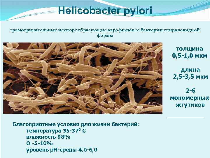 Helicobacter pylori грамотрицательные неспорообразующие аэрофильные бактерии спиралевидной формы толщина 0, 5 -1, 0 мкм