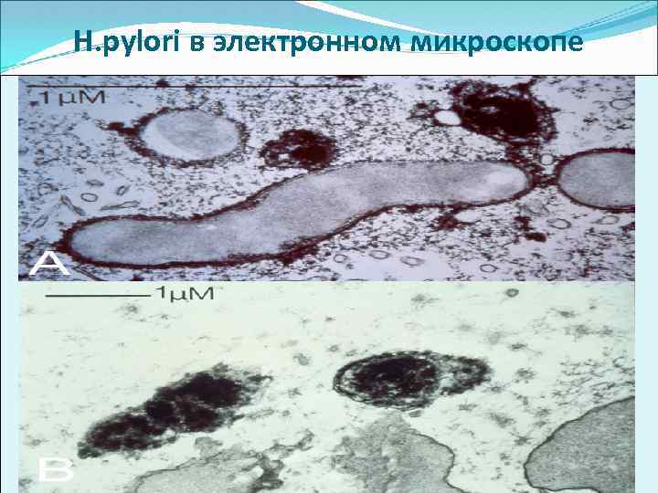 H. pylori в электронном микроскопе 