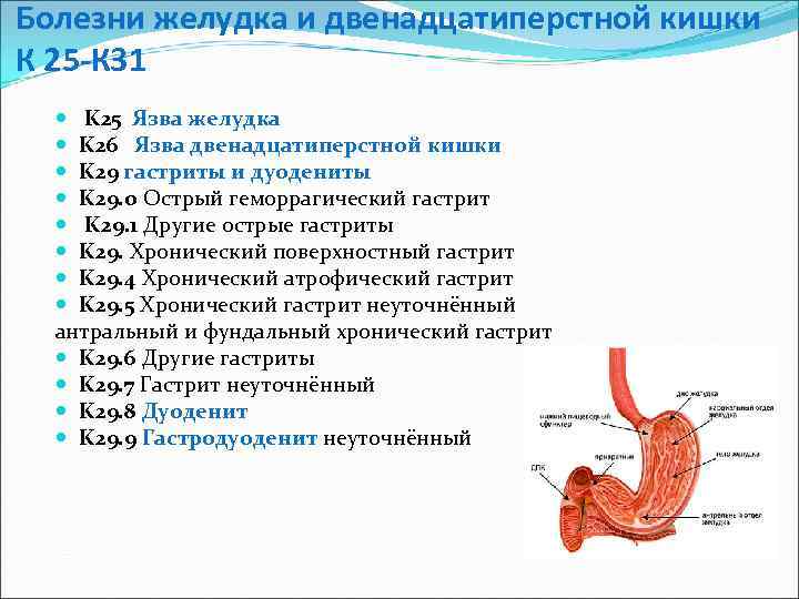 Болезни желудка и двенадцатиперстной кишки К 25 -К 31 K 25 Язва желудка K