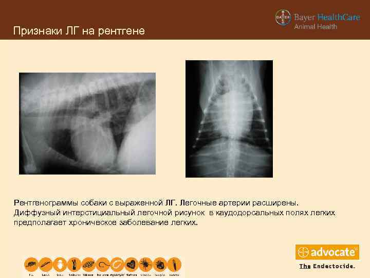 Признаки ЛГ на рентгене Рентгенограммы собаки с выраженной ЛГ. Легочные артерии расширены. Диффузный интерстициальный