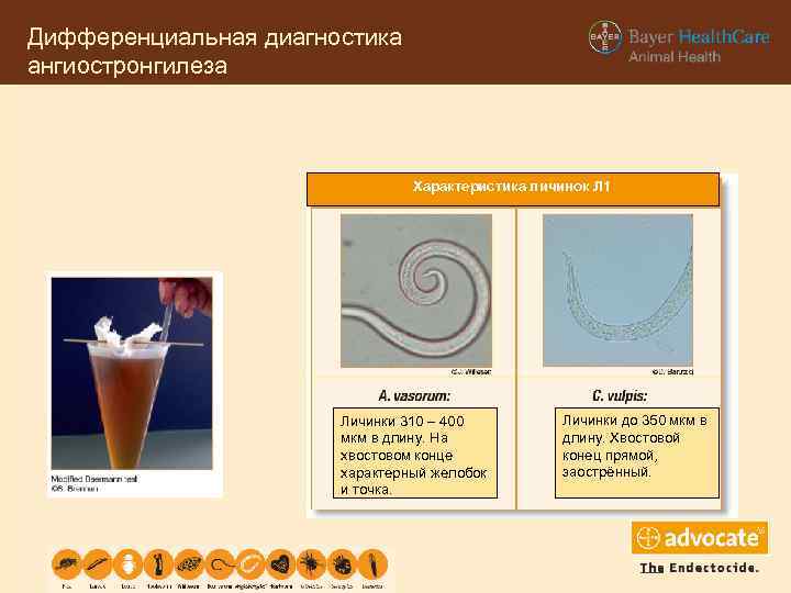 Дифференциальная диагностика ангиостронгилеза Характеристика личинок Л 1 Личинки 310 – 400 мкм в длину.