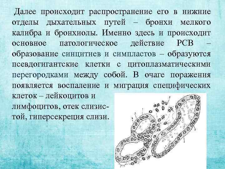  Далее происходит распространение его в нижние отделы дыхательных путей – бронхи мелкого калибра