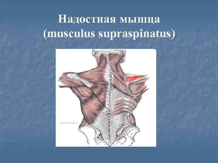 Надостная мышца (musculus supraspinatus) 