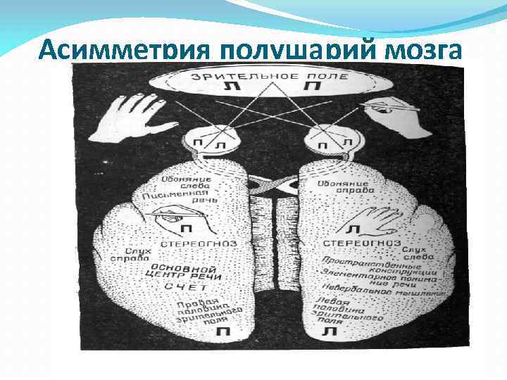 Асимметрия полушарий мозга 