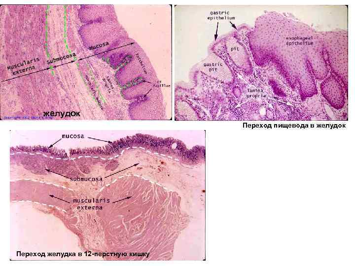 Переход пищевода в желудок гистология рисунок