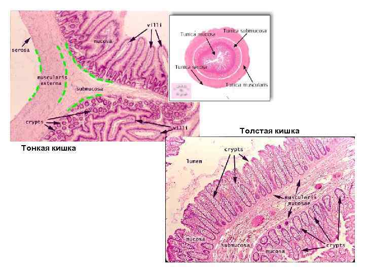Толстая кишка Тонкая кишка 