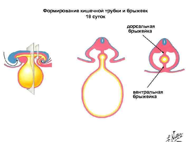 Брыжейка кишечника рисунок