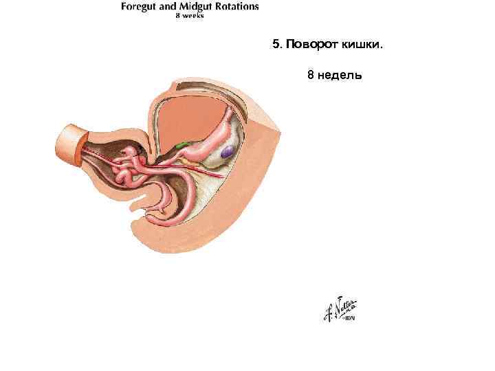 5. Поворот кишки. 8 недель 