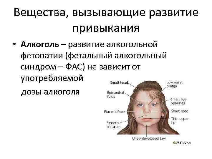 Вещества, вызывающие развитие привыкания • Алкоголь – развитие алкогольной фетопатии (фетальный алкогольный синдром –