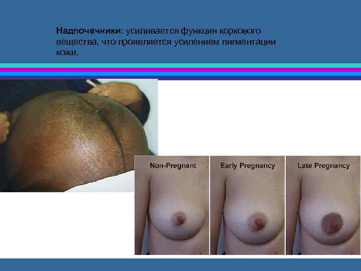 Надпочечники: усиливается функция коркового вещества, что проявляется усилением пигментации кожи. 