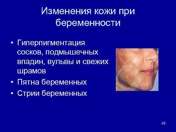 Изменения кожи при беременности • Гиперпигментация сосков, подмышечных впадин, вульвы и свежих шрамов •