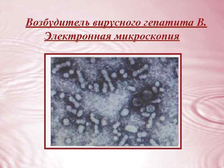 Возбудитель вирусного гепатита В. Электронная микроскопия 