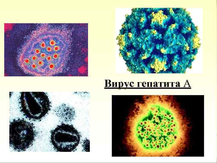 Вирус гепатита А 