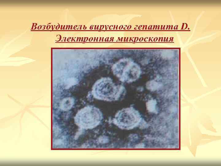 Возбудитель вирусного гепатита D. Электронная микроскопия 