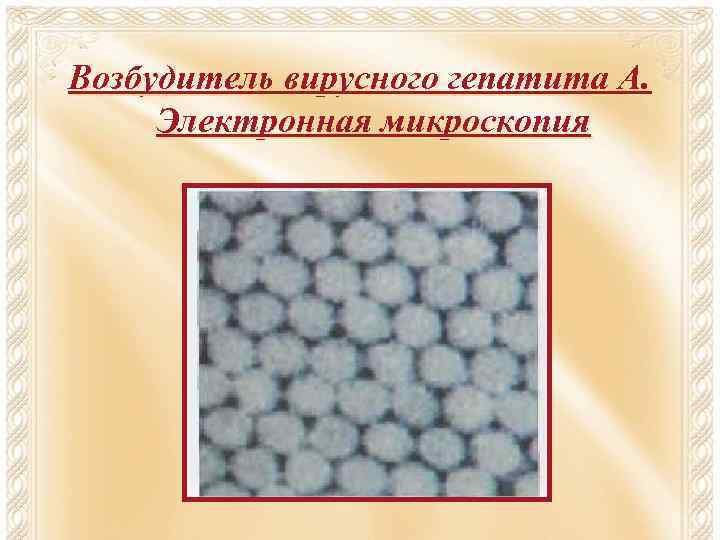 Возбудитель вирусного гепатита А. Электронная микроскопия 