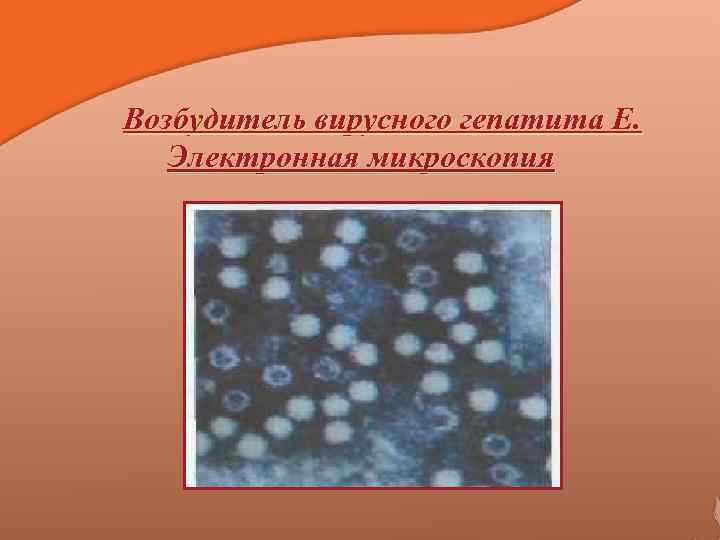 Возбудитель вирусного гепатита Е. Электронная микроскопия 