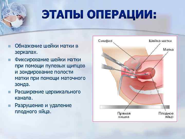 Цервикальный канал это