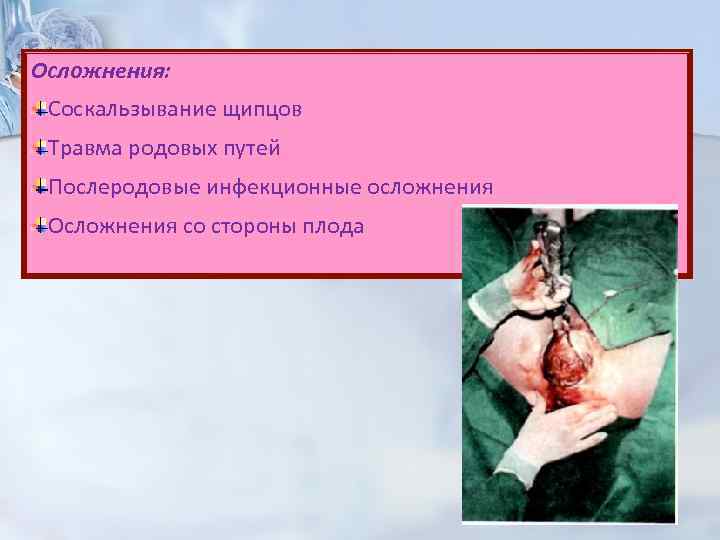 Осложнения: Соскальзывание щипцов Травма родовых путей Послеродовые инфекционные осложнения Осложнения со стороны плода 