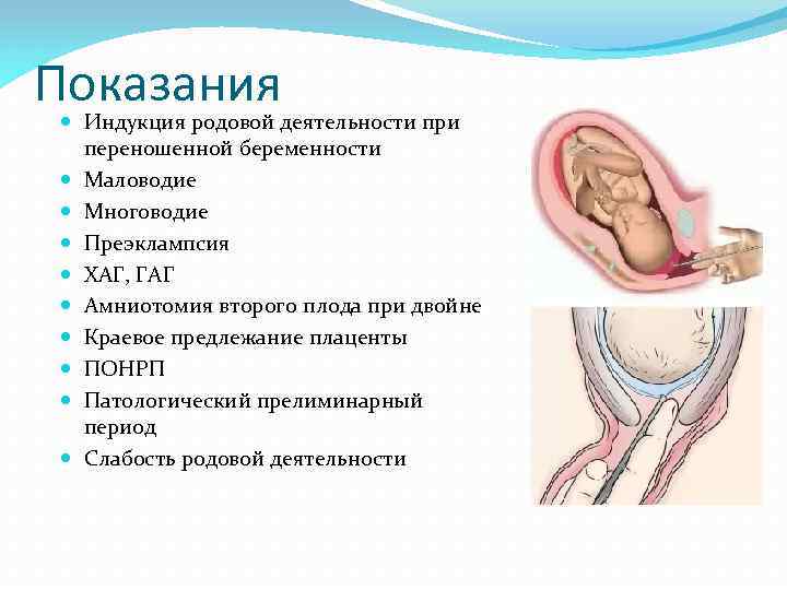 Показания Индукция родовой деятельности при переношенной беременности Маловодие Многоводие Преэклампсия ХАГ, ГАГ Амниотомия второго