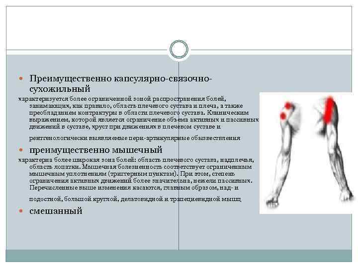  Преимущественно капсулярно-связочно- сухожильный характеризуется более ограниченной зоной распространения болей, занимающих, как правило, область