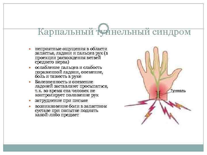 Карпальный туннельный синдром неприятные ощущения в области запястья, ладони и пальцев рук (в проекции