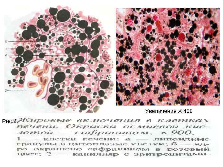 Увеличение Х 400 Рис. 2. 