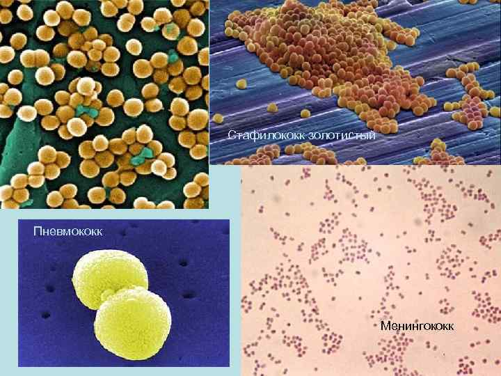 Стафилококк золотистый Пневмококк Менингококк 