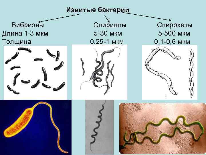 Извитые бактерии Вибрионы Длина 1 -3 мкм Толщина Спириллы 5 -30 мкм 0, 25