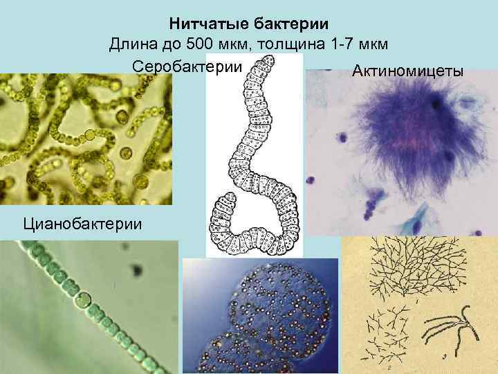 Нитчатые бактерии Длина до 500 мкм, толщина 1 -7 мкм Серобактерии Актиномицеты Цианобактерии 
