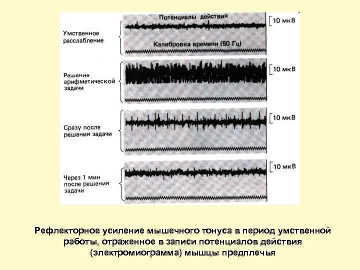 Рефлекторное усиление мышечного тонуса в период умственной работы, отраженное в записи потенциалов действия (электромиограмма)