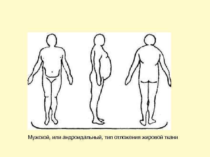 Мужской, или андроидальный, тип отложения жировой ткани 