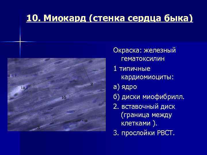 10. Миокард (стенка сердца быка) Окраска: железный гематоксилин 1 типичные кардиомиоциты: а) ядро б)