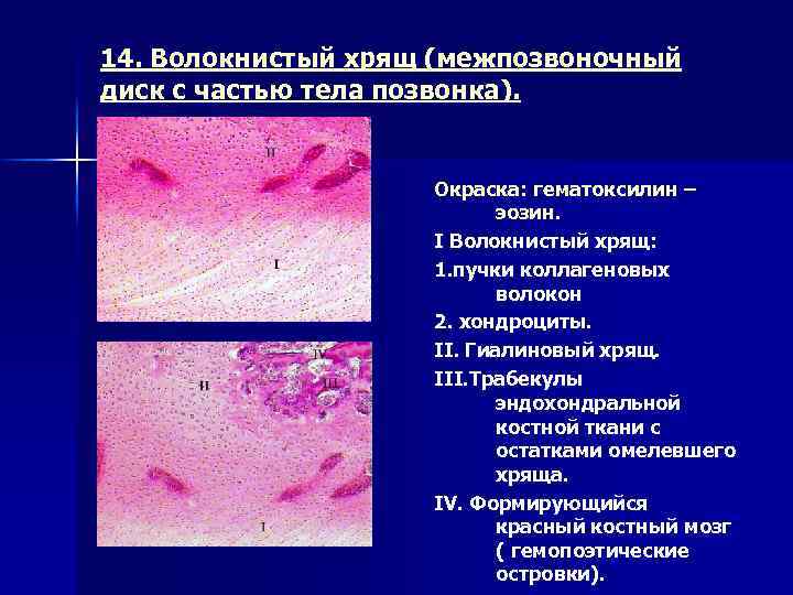 Волокнистый хрящ рисунок с подписями