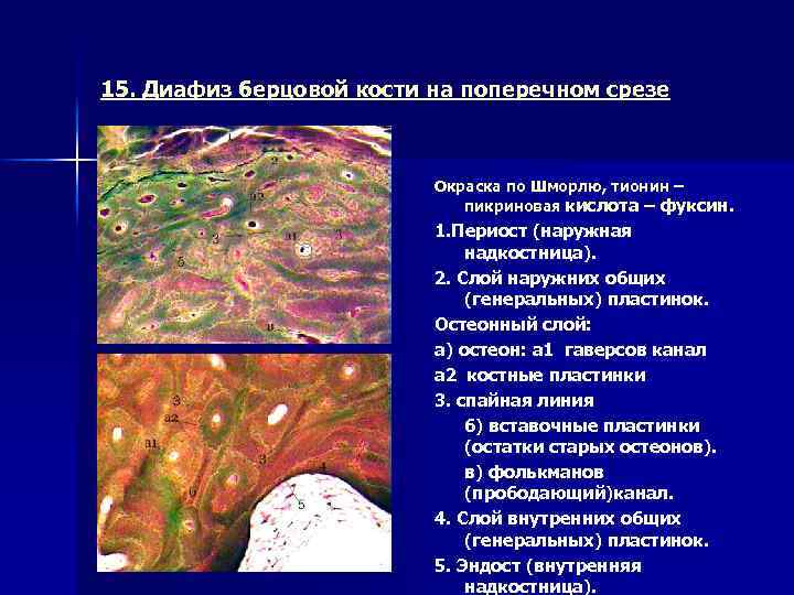 15. Диафиз берцовой кости на поперечном срезе Окраска по Шморлю, тионин – пикриновая кислота