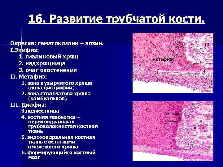 Ткань латынь. Эпифиз гистологический препарат. Эпифиз гистология препарат. Развитие эпифиза гистология. Срез эпифиза трубчатой кости.