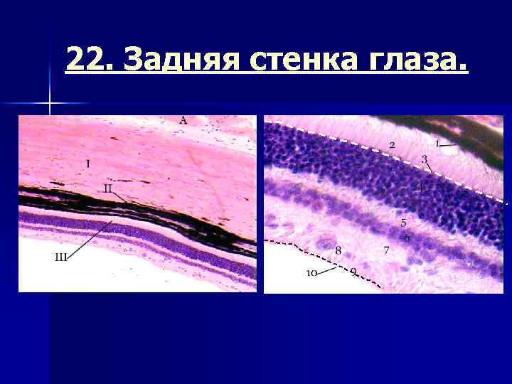 22. Задняя стенка глаза. 